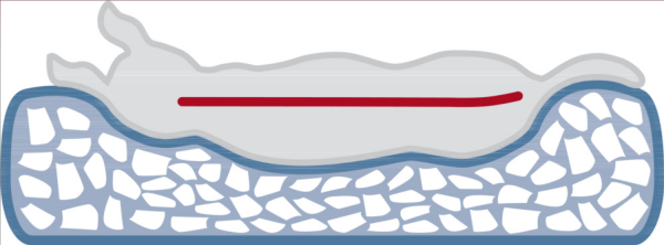 Trixie/Trixie_Vital_Kissen_Bendson_1_Zwärgehüsli-Shop.png